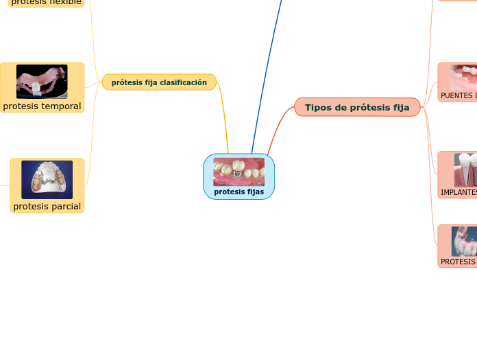 protesis fijas