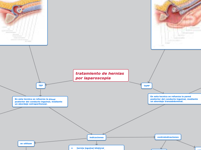 tratamiento de hernias