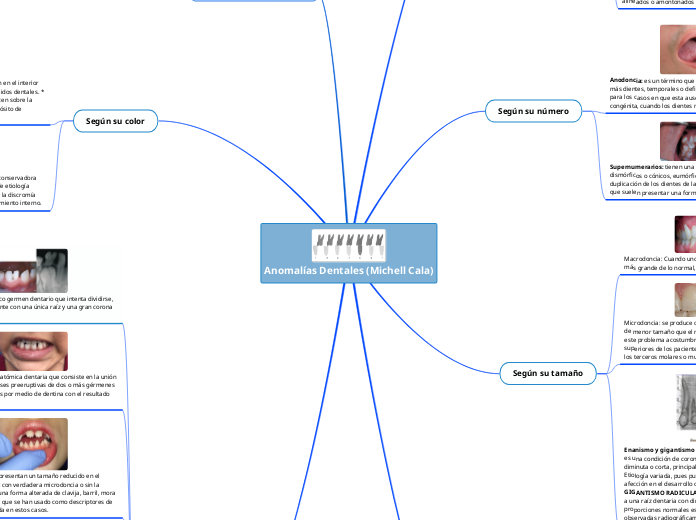Anomalías Dentales (Michell Cala)