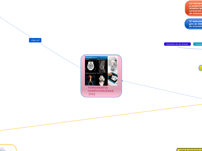 TOMOGRAFÍA COMPUTARIZADA
 (TC)