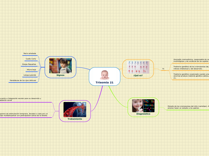 Trisomía 21