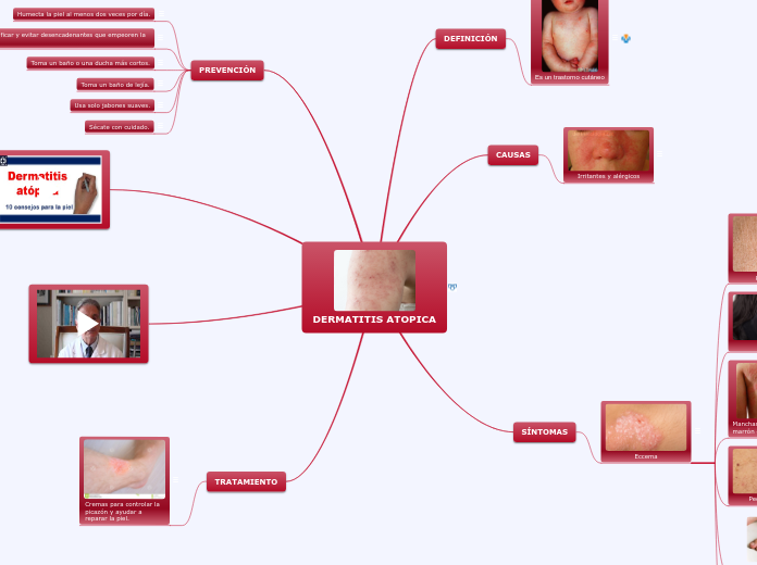 DERMATITIS ATOPICA