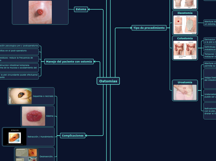 Ostomías