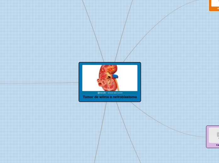 Tumor de wilms o nefroblastoma