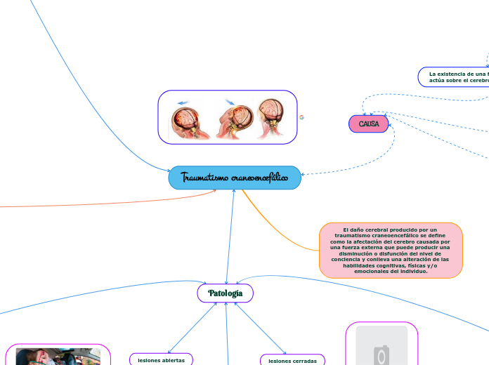 Traumatismo craneoencefálico