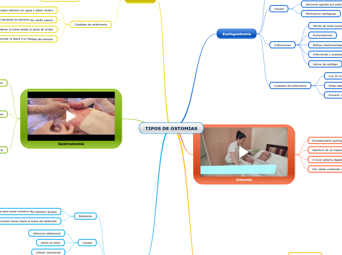 TIPOS DE OSTOMIAS