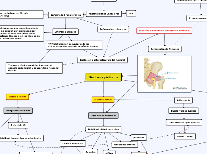 Sindrome piriforme