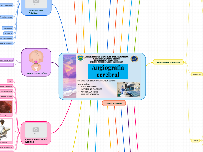 Angiografía  cerebral