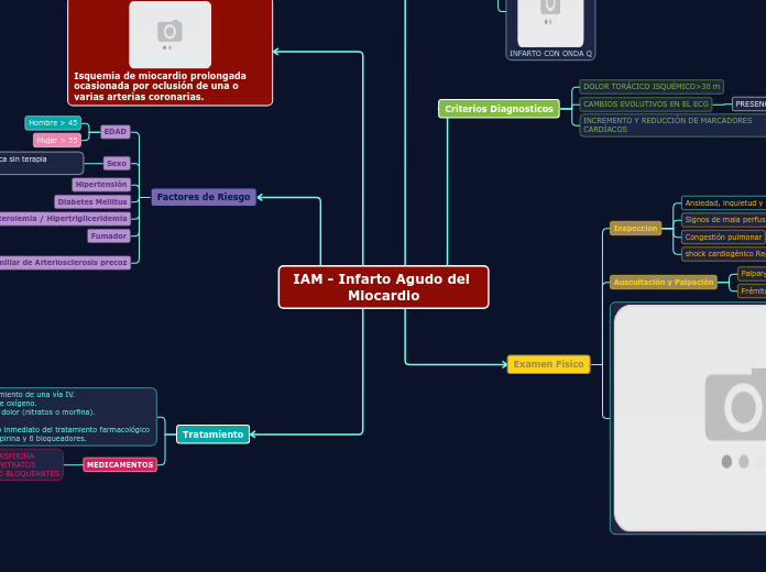 IAM - Infarto Agudo del Miocardio