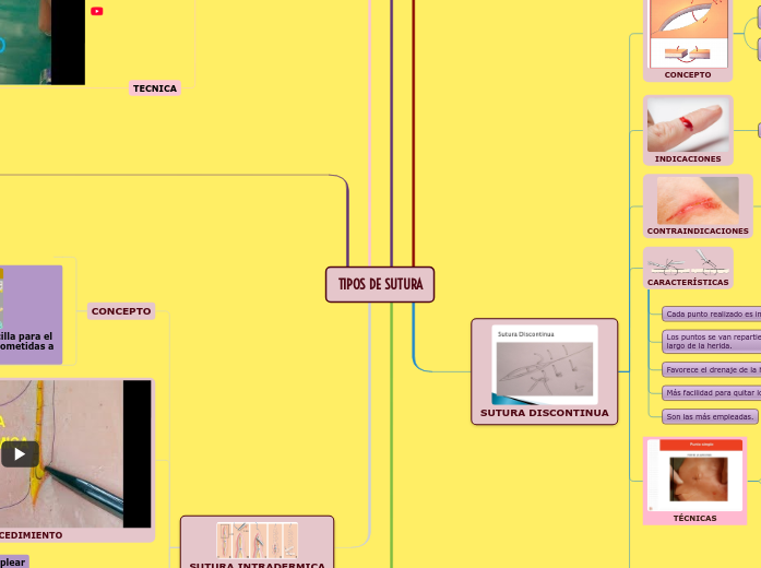 TIPOS DE SUTURA