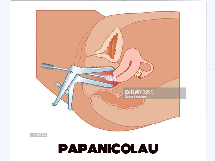 PAPANICOLAU