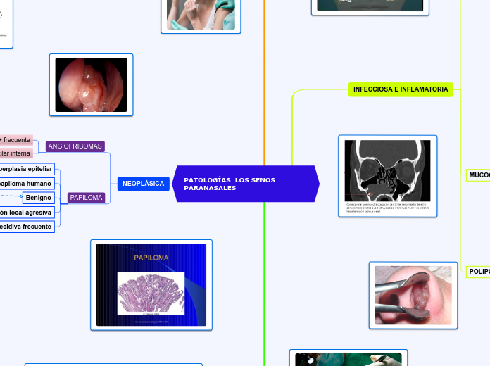 PATOLOGÍAS  LOS SENOS PARANASALES