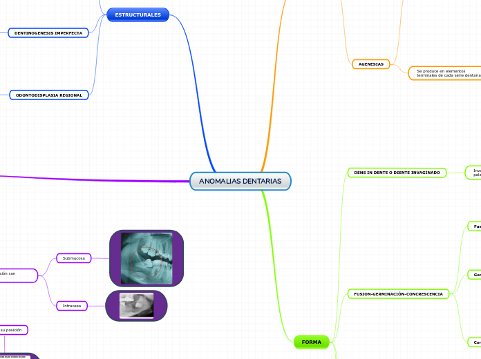 ANOMALIAS DENTARIAS