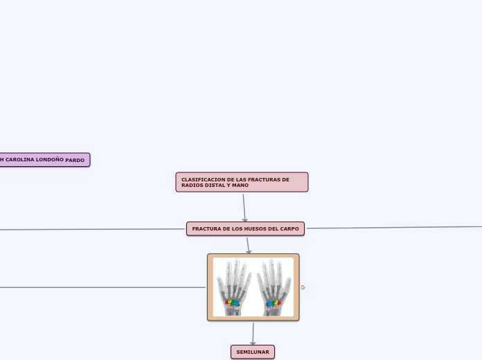 CLASIFICACION DE LAS FRACTURAS DE RADIOS DISTAL Y MANO