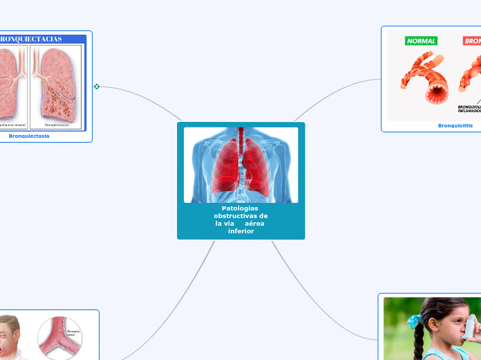 Patologías obstructivas de  la vía     aérea inferior