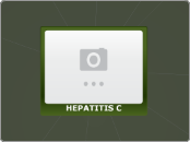 HEPATITIS C