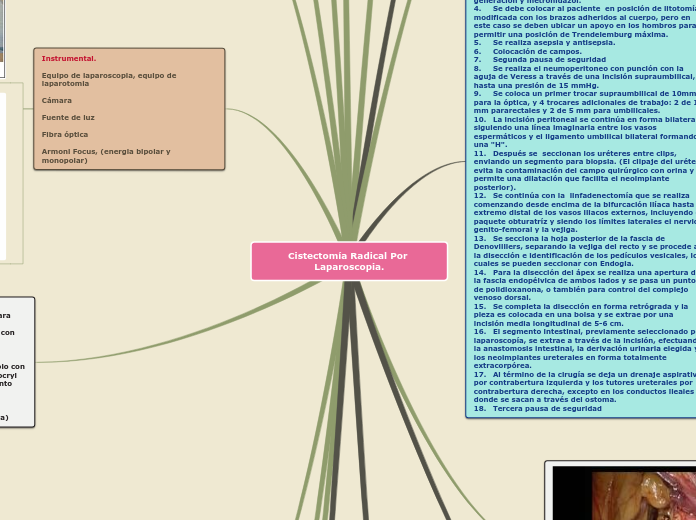 Cistectomía Radical Por Laparoscopia.