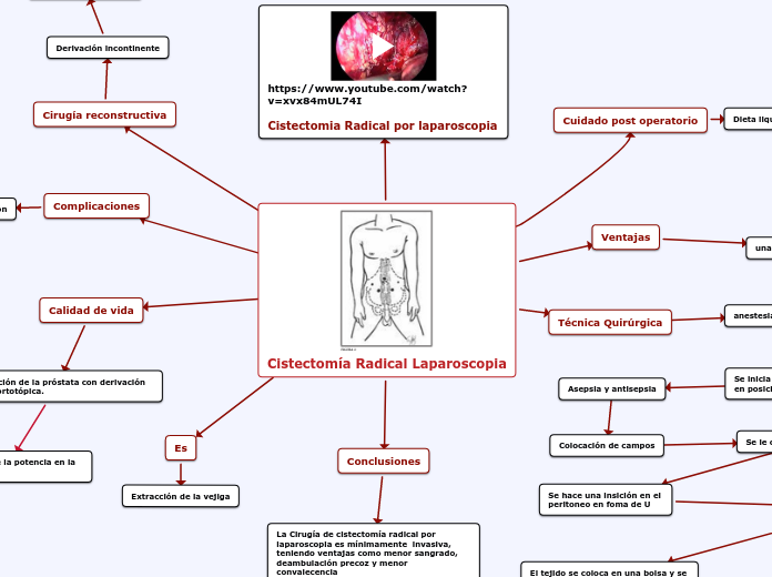 Cistectomía Radical Laparoscopia