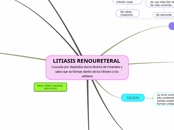 LITIASIS RENOURETERAL Causada por depósitos duros hechos de minerales y sales que se forman dentro de los riñones o los uréteres