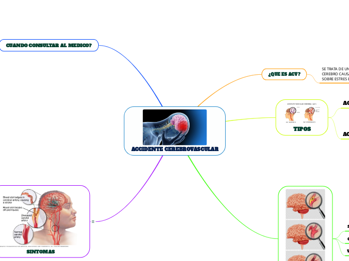 ACCIDENTE CEREBROVASCULAR