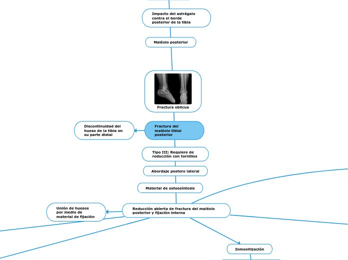 Fractura del maléolo tibial posterior