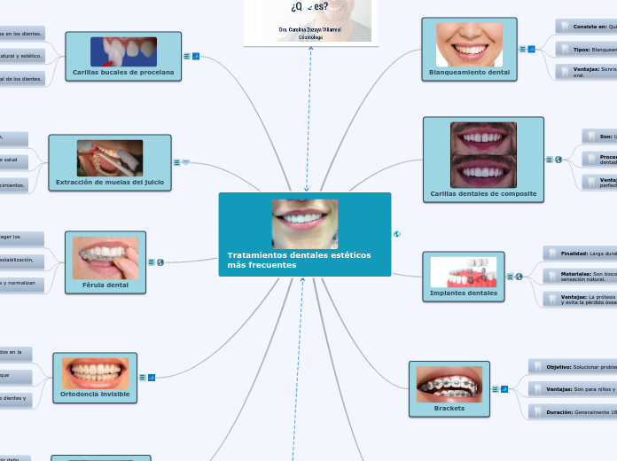 Tratamientos dentales estéticos más frecuentes