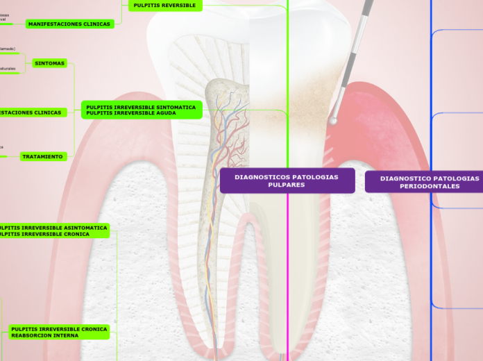 DIAGNOSTICOS PATOLOGIAS PULPARES 