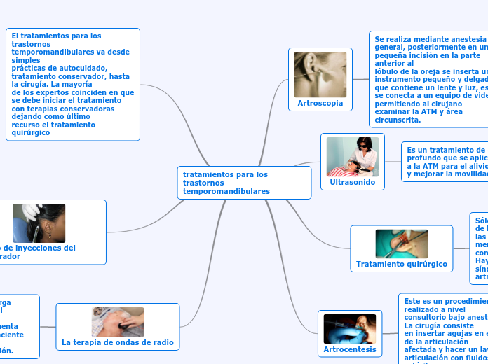 tratamientos para los trastornos
temporomandibulares