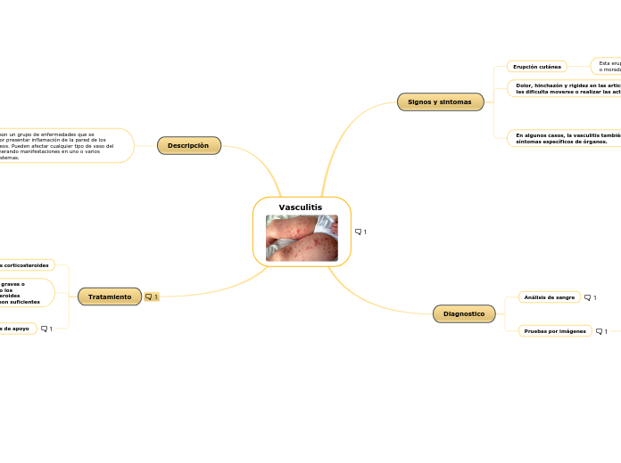 Vasculitis 